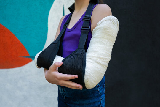 Unrecognizable girl with bone fracture in full arm cast and sling on colored background. Immobilization of elbow joint with splint.