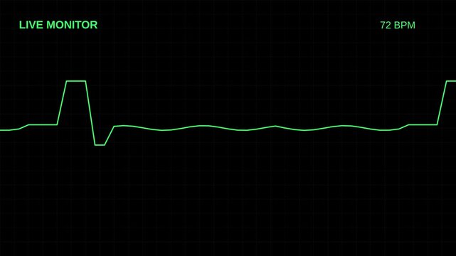 Real-Time Heart Rate Monitoring Display with Live ECG Graphs.