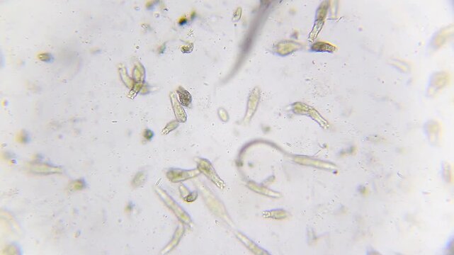 Biodiversity of nematodes rotifers and ciliates swimming in water drop under 100x brightfield microscopy
