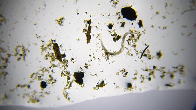 Single nematode roundworm wriggling through heavy organic sediment under 40x brightfield microscopy