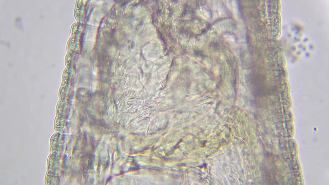 Extreme close-up of a large annelid worm internal body structure under 400x brightfield microscopy