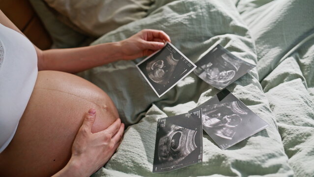 Close up sonogram photos pregnant belly. Woman holding ultrasound scan bed home.