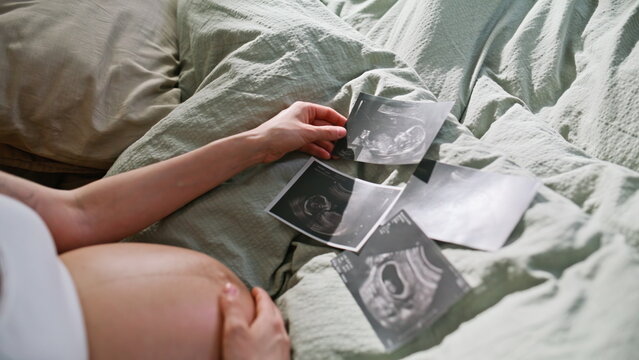 Closeup ultrasound photos pregnant belly bed. Woman examining sonogram scans.