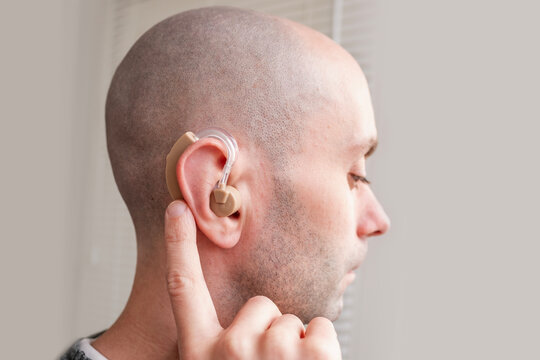 Young man with beige hearing aid in ear, close up portrait, BTE hearing support, accessibility, modern technology, inclusion, health care, confidence and everyday life, Modern healthcare solutions