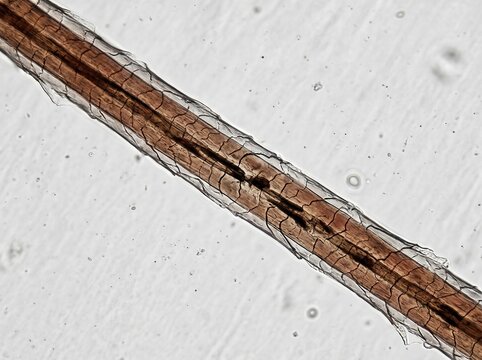 Microscopic View Of A Human Hair Strand