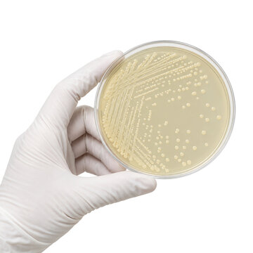 Gloved laboratory hand holding a Petri dish with cream-colored bacterial colonies growing on nutrient agar, isolated against a clean white background.