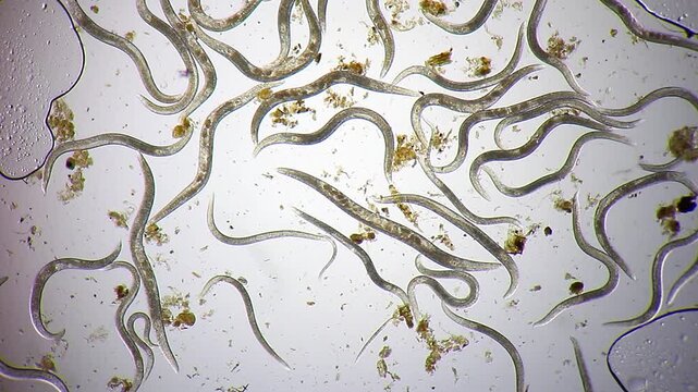 Large population of nematode roundworms wriggling in dirty water drop under 100x brightfield microscopy