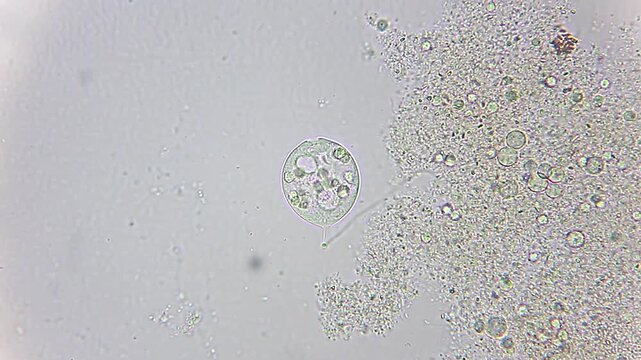 Vorticella ciliate protozoan filtering food near organic detritus under 400x brightfield microscopy