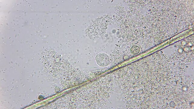 Vorticella ciliate attached near human hair strand surrounded by bacteria under 400x brightfield microscopy
