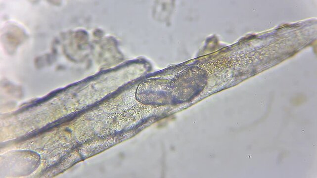 Extreme close-up of nematode roundworm body anatomy with a large egg under 400x brightfield microscopy