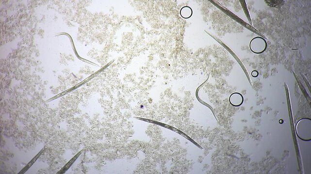 Multiple nematode roundworms moving slowly through organic detritus under 100x brightfield microscopy
