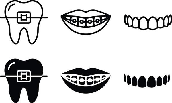 Collection of dental icons with teeth with braces and a smile with orthodontic treatment, vector graphic on a plain white background