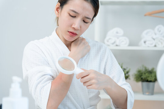 skin problem and beauty. asian woman use magnifying glass look itchy skin from skin allergic, shocked, steroid allergy, sensitive, chemical allergy, rash, insect bites, Seborrheic Dermatitis.