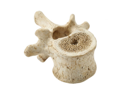 Real human vertebra bone structure showing porous cancellous interior isolated on transparent