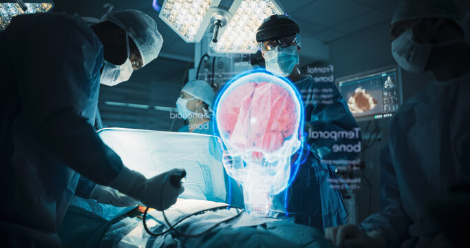 Neurosurgeon in an Ar Headset Studies a Glowing Holographic Brain and Skull Scan Above the Operating Table as Her Team Performs a Craniotomy to Remove a Tumor and Treat an Aneurysm in Hospital.