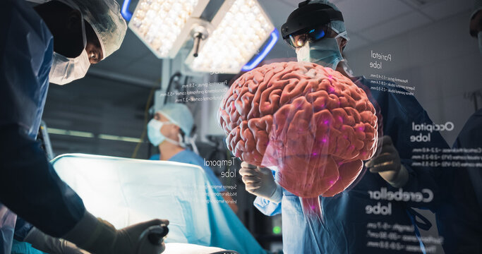 Surgeons Utilize Augmented Reality in a Sterile Operating Room, Usinh Holographic Brain Visuals to Enhance Precision in Neurosurgery, Chronic Disease Treatment With Innovative Medical Technology.