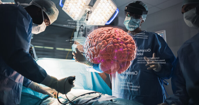 Surgeons in Ar Headsets Manipulating a Vivid Holographic Brain With Frontal and Parietal Lobe Data Mid-operation, Targeting Aneurysm, Tumor and Alzheimer's Therapy.