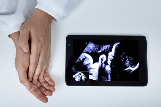 Obstetrician gynecologist holding hands near a digital tablet screen displaying a third trimester fetal ultrasound scan. Fetal development monitoring and pregnancy checkup.