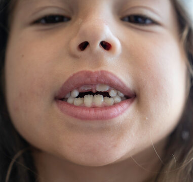 Generation alpha child shows mixed dentition and erupting permanent teeth in a close facial portrait. Detailed view highlights childhood dental development, oral health, and pediatric dentistry.
