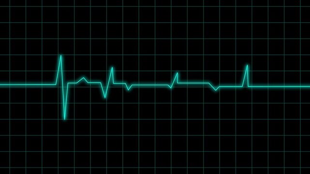 Heartbeat line animation pulses across a clinical medical screen. Hospital cardiogram pulse rate telemetry traces the heartbeat line. Patient cardiology health monitoring guides the heartbeat line.
