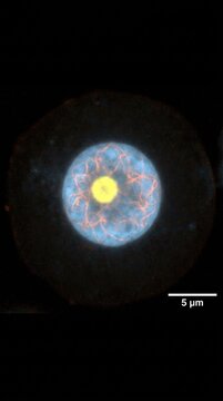Cell nucleus division demonstration, eukaryotic specimen showing bright yellow nucleolus with fluorescent chromatin network, microscopic biology tissue organelle under micrometer scale bar.