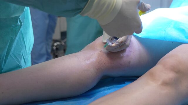 Medical professional performing an intra-articular injection in a patient's knee joint to treat osteoarthritis, inflammation, or sports injuries with a syringe and needle in an operating room