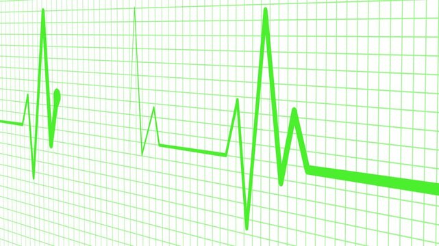 Digital Heartbeat Wave Animation with Medical ECG Signal Display