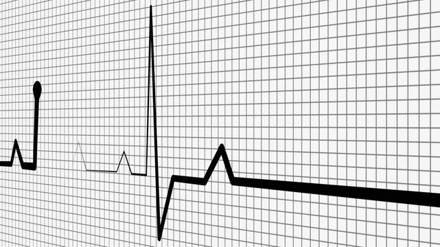 Modern Healthcare ECG Animation with Cardiac Monitoring Line