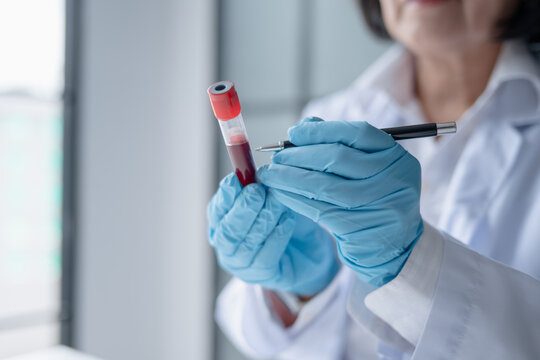 Female medical laboratory technician holding blood sample tube for laboratory testing at clinical laboratory.
