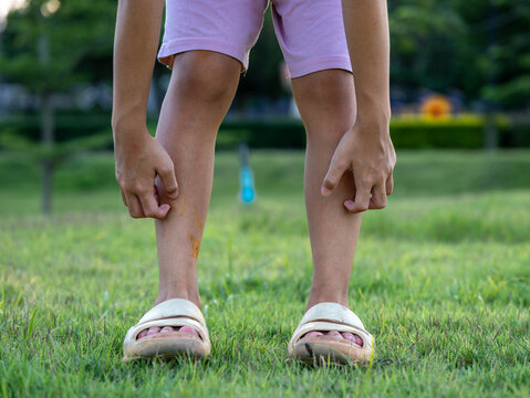 Low section of child standing on grass bending down to scratch itchy insect bites on both legs