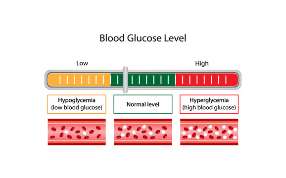 Blood Glucose Levels. Normal level, hypoglycemia (low blood sugar), hyperglycemia (high blood sugar), sugar test. Vector diagram.