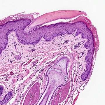 Microscopic View Of Mammalian Skin Showing Epidermis Dermis And Subcutaneous Layers