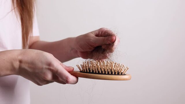 Close up of excessive hair loss and shedding on a hairbrush, representing hair health problems and alopecia