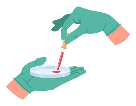 Lab blood test. Hands holding petri dish with blood sample, lab worker hands in rubber gloves flat vector illustration. Laboratory assistant holding medical tools