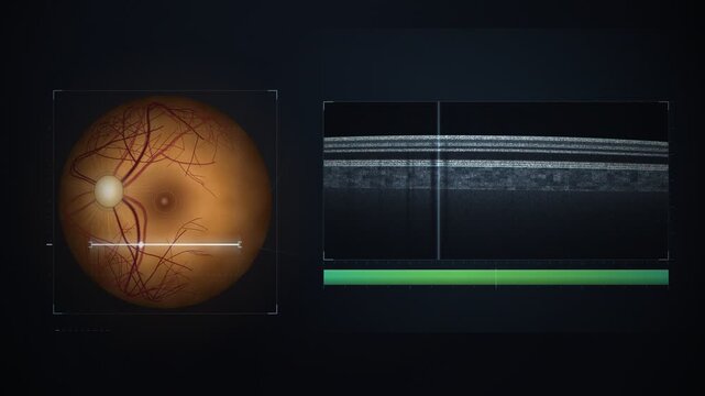 Retinal Fundus and OCT Eye Scan Seamless Loop