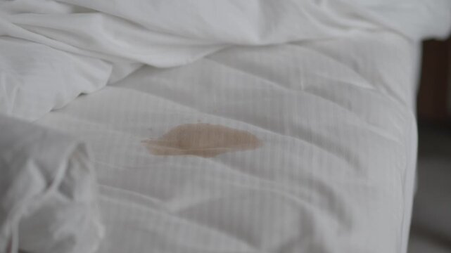 There is a noticeable stain on the bed sheet in the hotel room