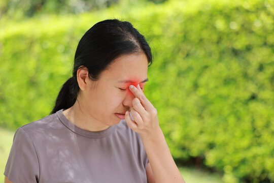 Stressed young Asian woman pinching nose bridge with red highlighted area indicating severe sinus pain, eye strain, allergy or migraine headache. Healthcare, sickness and medical concept outdoors.