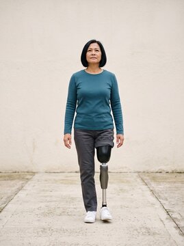 Confident Asian Woman Walking on Above Knee Prosthetic Leg