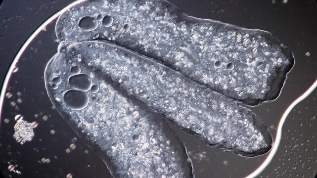 Silver Amoeba Showing Ectoplasm Flow and Internal Cellular Movement