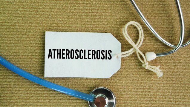 Stethoscope and paper tag with word Atherosclerosis. disease where sticky plaque made of fat, cholesterol, and calcium builds up inside your arteries, narrowing them and limiting blood flow.