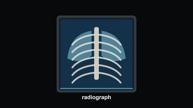 Animated Chest X-ray Medical Imaging Scan Display