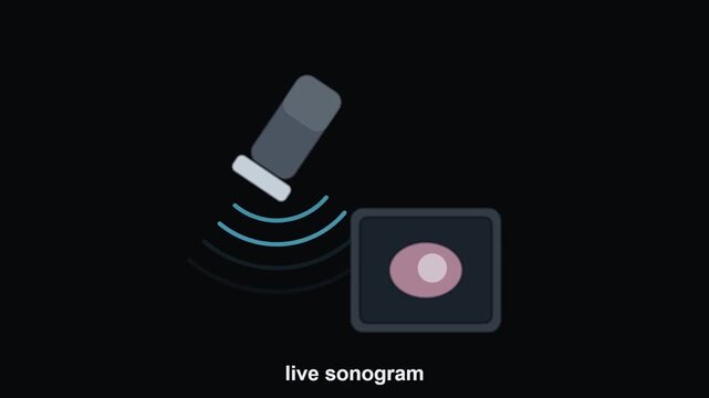 Animated Ultrasound Probe Scanning Medical Imaging