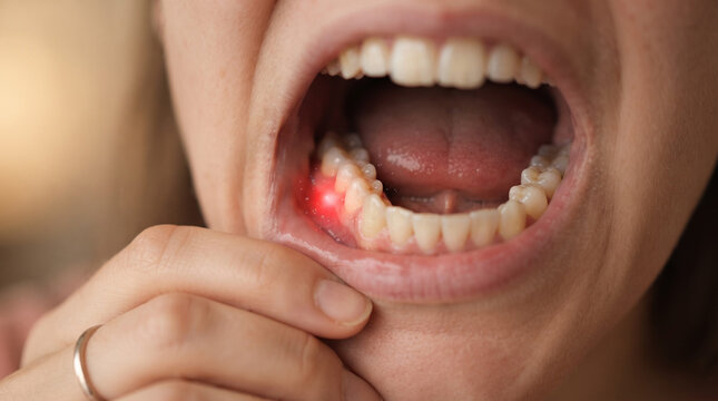Young man standing, close-up view, bright daylight, close-up of an open mouth showing teeth, hand pulling cheek, dental health concept. Banner, copy space