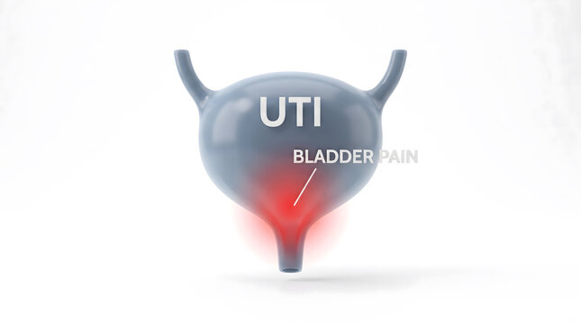 Medical illustration of urinary tract infection and bladder pain