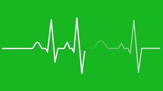 Medical Scene Showing Steady Pulse Line in Bright Green Setting