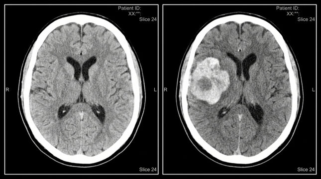 x ray of a human brain