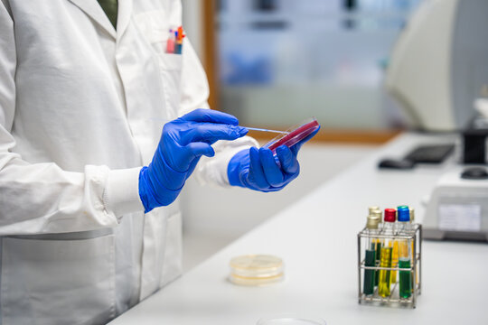 Scientist Conducts Research in a Laboratory With Petri Dish