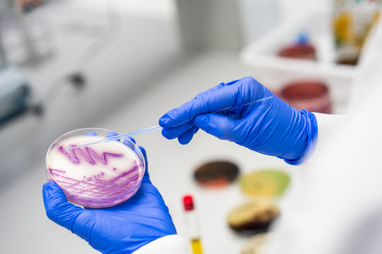 Laboratory Technician Works With Petri Dish at Science Lab