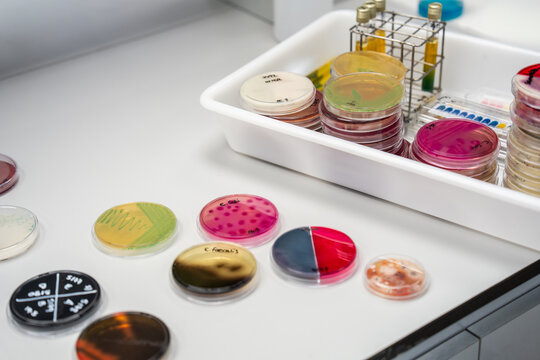 Samples of Petri Dishes Arranged on a Laboratory Table