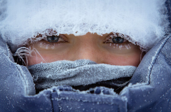 Frost-Covered Eyes in Winter